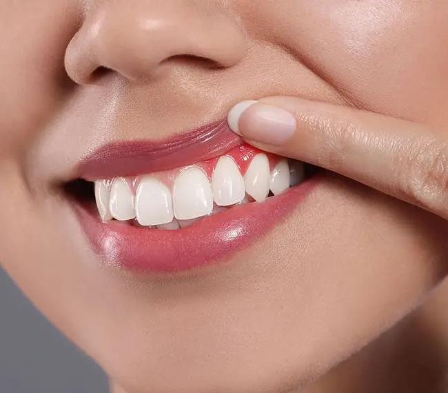 Close-up of person's smile displaying bright white teeth and healthy gums against neutral background.