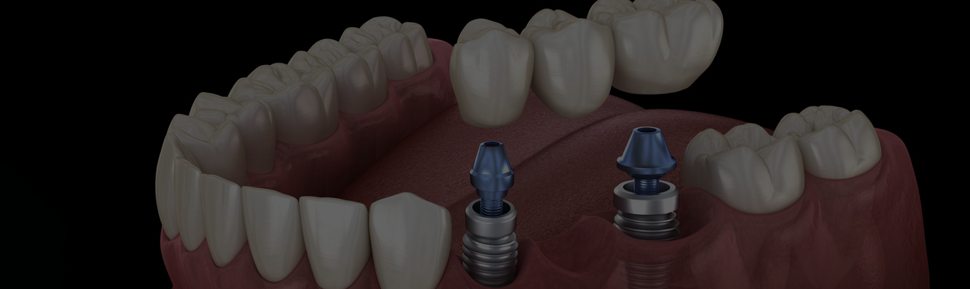 Miniature dental professionals examining large tooth model in clinical setting.