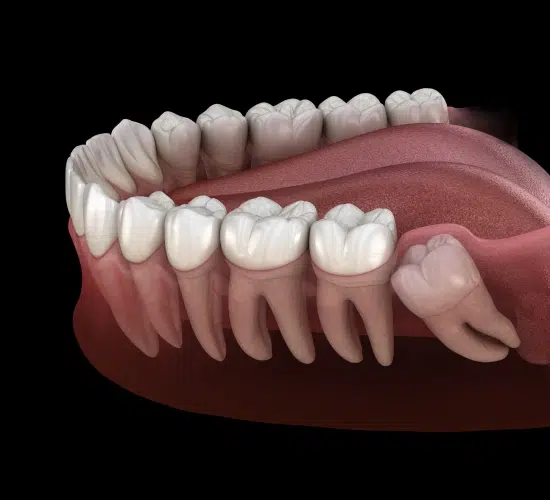 3D dental illustration showing complete upper and lower teeth anatomy with gums and bone structure