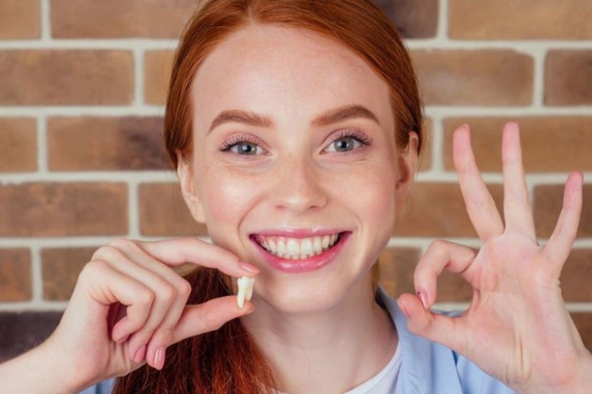 Dentist Wants You to Know About Wisdom Teeth