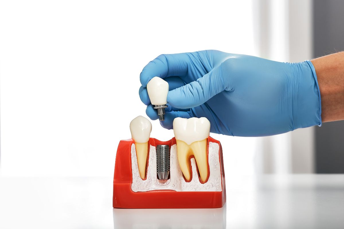 Dental Implants Feel More Like Natural Teeth