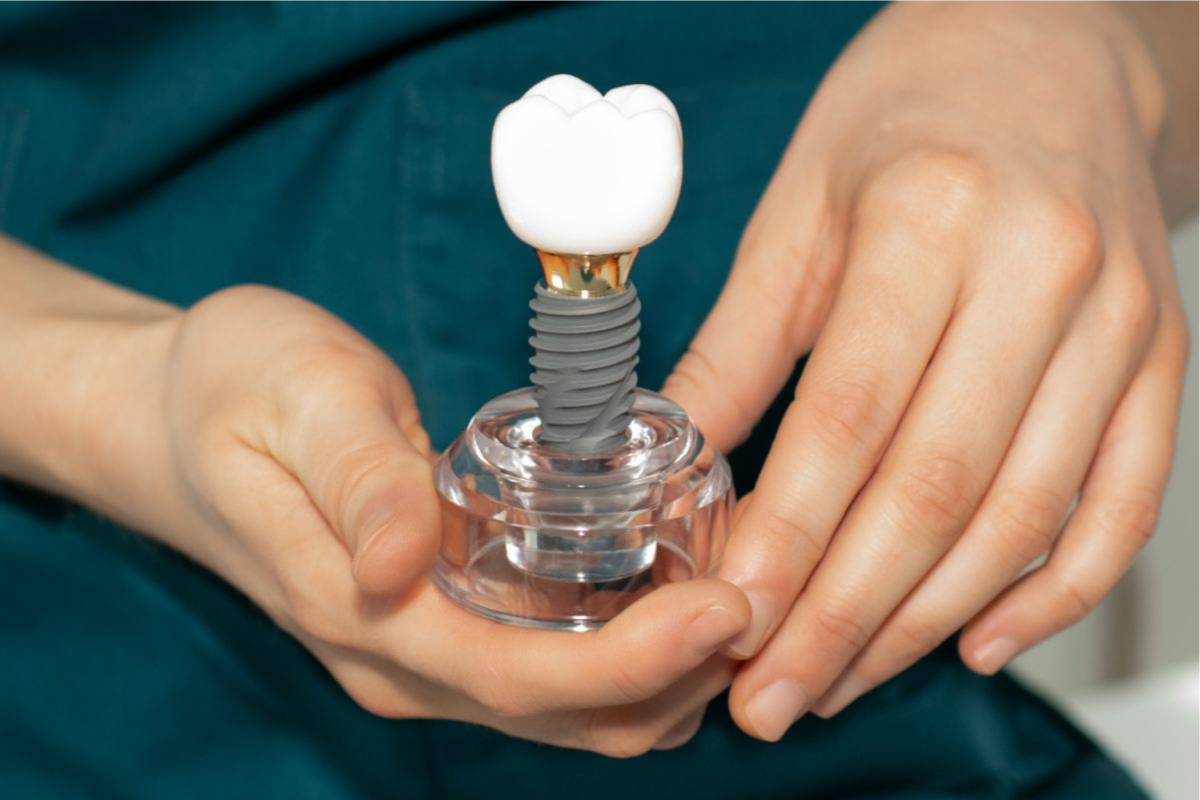 McKinney Dental Implants