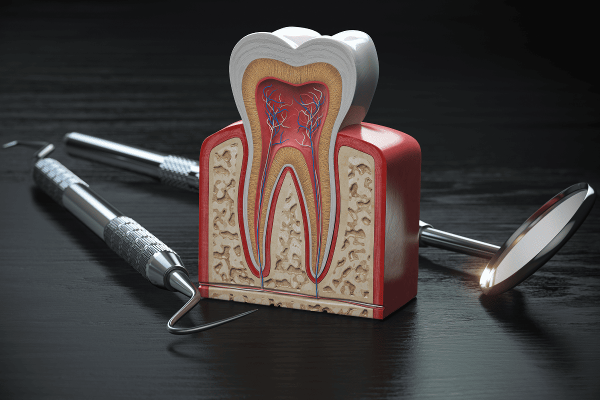 bone grafting McKinney